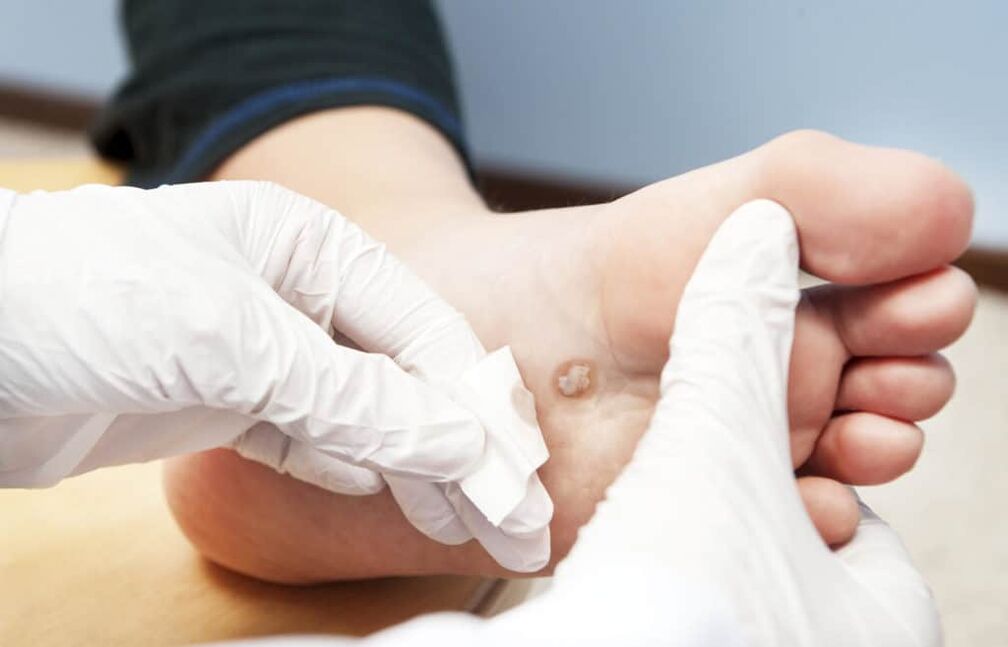 de ce apar negi pe corp